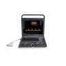УЗИ аппарат SonoScape S8Exp